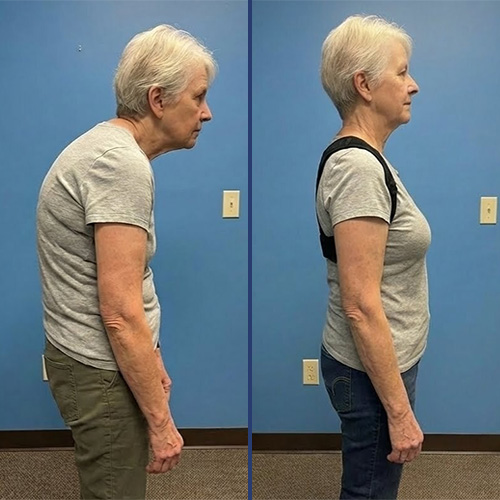 TrueFit Posture Corrector